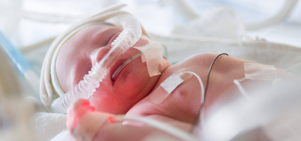 NICU Core Respiratory & Life Support System