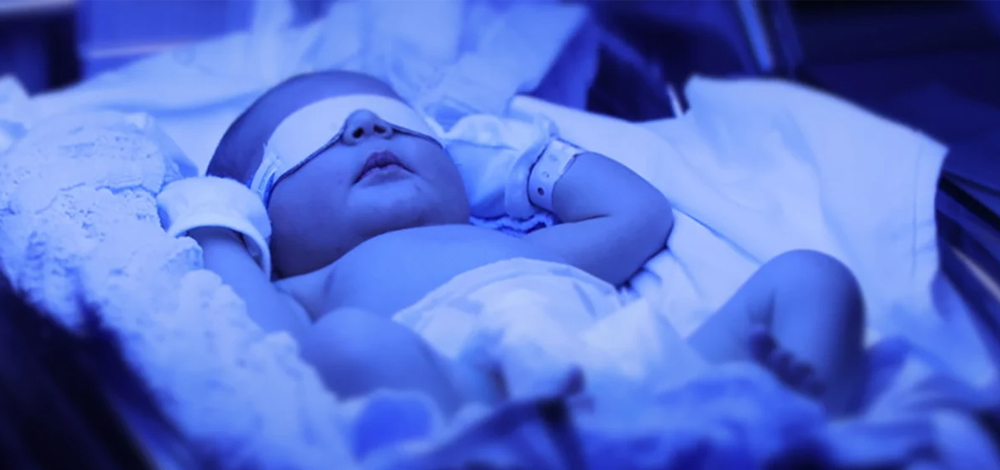 Integrated Jaundice Diagnosis & Treatment System